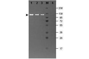 Image no. 1 for anti-Galactosidase, beta 1 (GLB1) antibody (ABIN1607729)