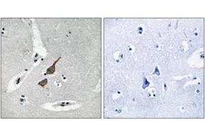 Image no. 2 for anti-Glutamate Receptor, Ionotropic, delta 1 (GRID1) (AA 831-880) antibody (ABIN1534412)