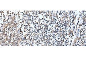 Immunohistochemistry of paraffin-embedded Human tonsil tissue using DEFB104A Polyclonal Antibody at dilution of 1:50(x200)