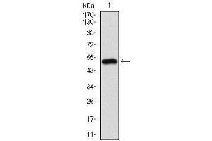 Western blot analysis using CD10 mAb against human CD10 (AA: 52-246) recombinant protein.