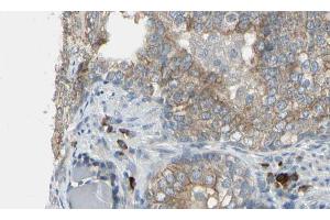 Image no. 1 for anti-Cell Division Cycle Associated 3 (CDCA3) (C-Term) antibody (ABIN6257051)