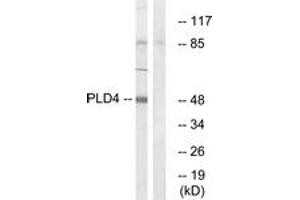 Image no. 1 for anti-Phospholipase D4 (PLD4) (AA 457-506) antibody (ABIN1535173)