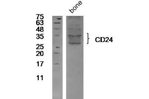 Image no. 2 for anti-CD24 Molecule (CD24) (AA 27-59) antibody (ABIN1385285)