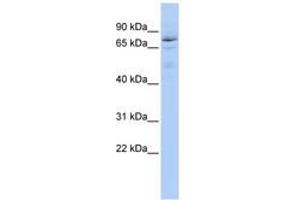 Image no. 1 for anti-Hypermethylated in Cancer 1 (HIC1) (AA 899-948) antibody (ABIN6742807)