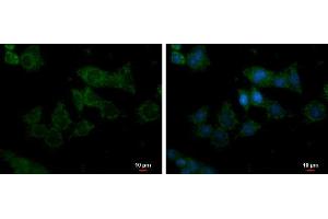 Image no. 2 for anti-Glycerol Kinase (GK) (Internal Region) antibody (ABIN2855352)
