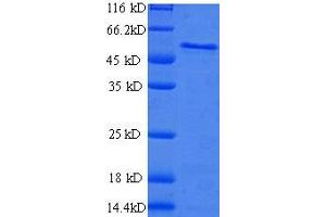 Image no. 1 for B-Cell Receptor-Associated Protein 31 (BCAP31) (AA 2-243), (partial) protein (GST tag) (ABIN1046592)