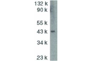 Image no. 1 for anti-DNA Fragmentation Factor, 45kDa, alpha Polypeptide (DFFA) (N-Term) antibody (ABIN6657783)