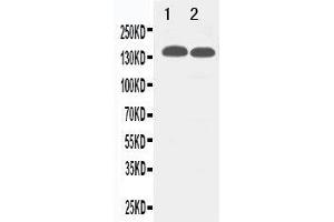 Image no. 2 for anti-Tight Junction Protein 2 (Zona Occludens 2) (TJP2) (AA 1171-1190), (C-Term) antibody (ABIN3044027)