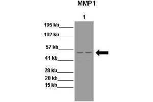Image no. 8 for anti-Matrix Metallopeptidase 1 (Interstitial Collagenase) (MMP1) (N-Term) antibody (ABIN2777119)