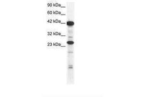Image no. 2 for anti-SIX Homeobox 6 (SIX6) (AA 41-90) antibody (ABIN6735817)