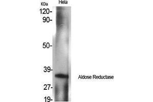 Image no. 2 for anti-Aldo-Keto Reductase Family 1, Member B1 (Aldose Reductase) (AKR1B1) (C-Term) antibody (ABIN3183249)
