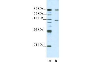 Image no. 1 for anti-Poly(A) Binding Protein, Cytoplasmic 4 (Inducible Form) (PABPC4) (N-Term) antibody (ABIN2778874)