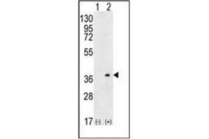 Image no. 2 for anti-Major Histocompatibility Complex, Class II, DQ alpha 1 (HLA-DQA1) (AA 46-74), (N-Term) antibody (ABIN952756)