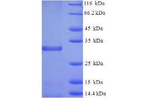 Image no. 1 for Baculoviral IAP Repeat-Containing 5 (BIRC5) (AA 1-140), (full length) protein (His-SUMO Tag) (ABIN5709139)