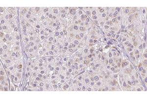 Image no. 1 for anti-Complement Factor H-Related 1 (CFHR1) antibody (ABIN6260778)