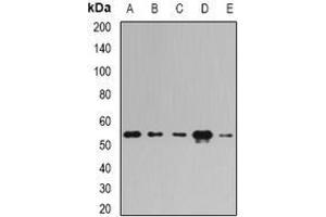 Image no. 2 for anti-Pyruvate Dehydrogenase Complex, Component X (PDHX) (full length) antibody (ABIN6004320)