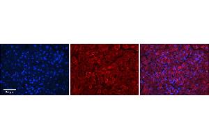 Image no. 1 for anti-Glyoxylate Reductase/hydroxypyruvate Reductase (GRHPR) (N-Term) antibody (ABIN2783330)