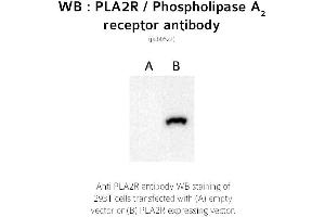 Image no. 1 for anti-phospholipase A2 Receptor 1, 180kDa (PLA2R1) (C-Term) antibody (ABIN347712)