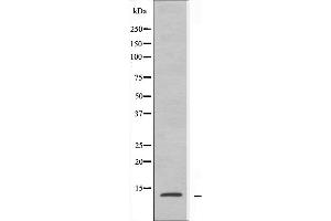 Image no. 2 for anti-Ribosomal Protein L30 (RPL30) (C-Term) antibody (ABIN6258400)