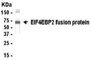 Image no. 1 for anti-Eukaryotic Translation Initiation Factor 4E Binding Protein 2 (EIF4EBP2) (AA 1-120) antibody (ABIN2467809)
