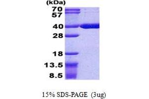 Image no. 1 for Acyl-CoA Thioesterase 8 (ACOT8) (AA 1-319) protein (His tag) (ABIN5852990)