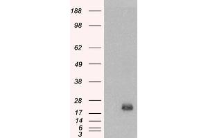 Image no. 1 for anti-Brain and Acute Leukemia, Cytoplasmic (BAALC) (Internal Region) antibody (ABIN334357)