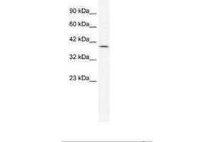Image no. 1 for anti-Gastrulation Brain Homeo Box 2 (GBX2) (AA 181-230) antibody (ABIN202301)