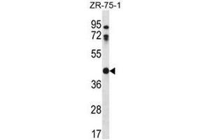 Image no. 2 for anti-Cathepsin O (CTSO) (AA 76-106), (N-Term) antibody (ABIN951067)