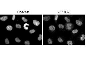 Image no. 3 for anti-Pogo Transposable Element with ZNF Domain (POGZ) (AA 1-562) antibody (ABIN2452078)