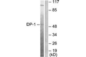 Image no. 3 for anti-Transglutaminase 4 (Prostate) (TGM4) (AA 361-410) antibody (ABIN1533257)