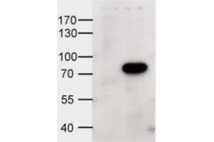 Image no. 1 for anti-ATP-Binding Cassette, Sub-Family D (Ald), Member 1 (ABCD1) (Internal Region) antibody (ABIN334339)