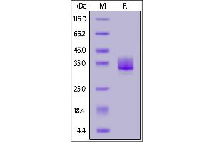 Image no. 2 for Sialic Acid Binding Ig-Like Lectin 15 (SIGLEC15) (AA 20-263) protein (His tag) (ABIN6809919)