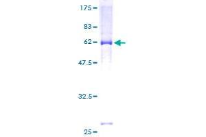 Image no. 1 for Potassium Voltage-Gated Channel, KQT-Like Subfamily, Member 2 (KCNQ2) (AA 1-393) protein (GST tag) (ABIN1308478)