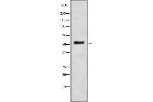 Image no. 1 for anti-Interferon-Induced Protein with Tetratricopeptide Repeats 1 (IFIT1) (Internal Region) antibody (ABIN6262448)