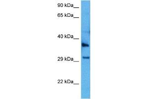 Image no. 4 for anti-Gap Junction Protein, beta 1, 32kDa (GJB1) (C-Term) antibody (ABIN2774855)