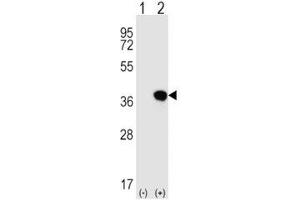 Image no. 2 for anti-HLA Class I Histocompatibility Antigen, alpha Chain G (HLAG) (AA 62-89) antibody (ABIN3031240)