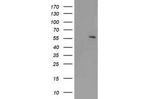 Image no. 2 for anti-Peroxisome Proliferator-Activated Receptor alpha (PPARA) (AA 145-420) antibody (ABIN2729417)