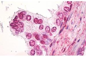 Image no. 1 for anti-Synovial Sarcoma Translocation, Chromosome 18 (SS18) (AA 1-50) antibody (ABIN2879100)