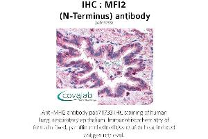 Image no. 2 for anti-Antigen P97 (Melanoma Associated) Identified By Monoclonal Antibodies 133.2 and 96.5 (MFI2) (N-Term) antibody (ABIN1736927)