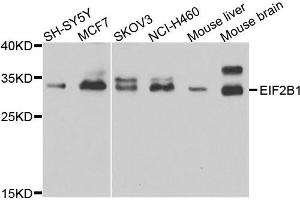 Image no. 1 for anti-Eukaryotic Translation Initiation Factor 2B, Subunit 1 Alpha, 26kDa (EIF2B1) antibody (ABIN2736685)