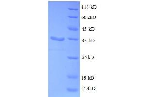 SDS-PAGE (SDS) image for 30S Ribosomal Protein S21 (RpsU) (AA 2-71), (full length) protein (GST tag) (ABIN1046340)