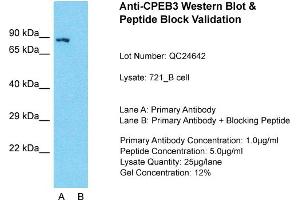 Image no. 2 for anti-Cytoplasmic Polyadenylation Element Binding Protein 3 (CPEB3) (Middle Region) antibody (ABIN2786058)