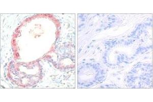 Image no. 2 for anti-REL proto-oncogene (c-Rel) (AA 470-519), (pSer503) antibody (ABIN1531963)