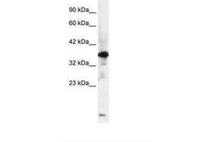 Image no. 2 for anti-Zinc Finger Protein-Like 1 (ZFPL1) (AA 101-150) antibody (ABIN6735842)