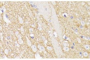Immunohistochemistry of paraffin-embedded Mouse brain using SEPT5 Polyclonal Antibody at dilution of 1:100 (40x lens).