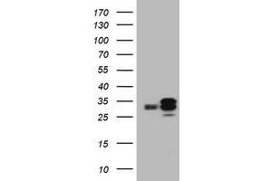 Image no. 6 for anti-Palmitoyl-Protein Thioesterase 1 (PPT1) (AA 100-306) antibody (ABIN1490802)