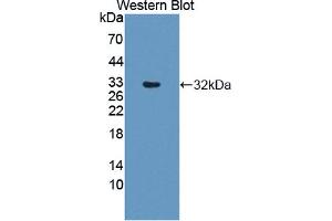 Image no. 1 for anti-Dihydropyrimidine Dehydrogenase (DPYD) (AA 169-422) antibody (ABIN1867627)