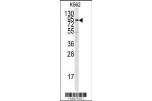 Image no. 3 for anti-Plasminogen (PLG) (AA 636-665), (C-Term) antibody (ABIN391479)