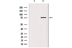 Western blot analysis of extracts from mouse brain, using HKR1 Antibody.