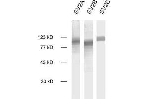 Image no. 1 for anti-Synaptic Vesicle Glycoprotein 2B (SV2B) (AA 2-17) antibody (ABIN1742258)